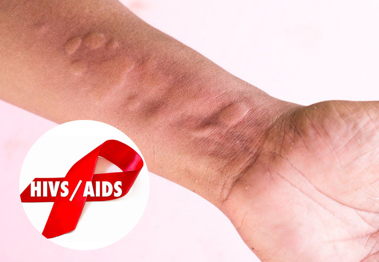noi-me-day-do-hiv