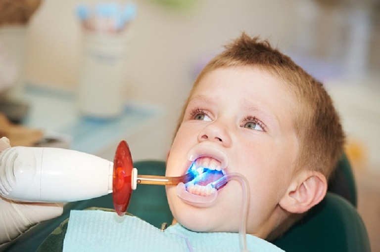Trám răng thường được chỉ định với trường hợp bé bị sâu răng giai đoạn đầu