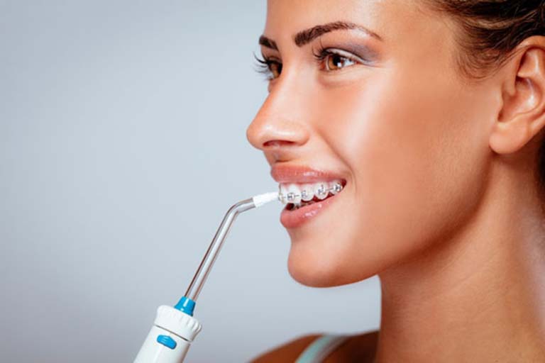 Chú ý vệ sinh răng miệng thật kỹ để tránh úa vàng hay mắc các bệnh răng miệng trong quá trình chỉnh nha