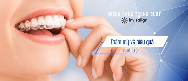 Niềng răng vô hình cần được thực hiện ở các nha khoa uy tín