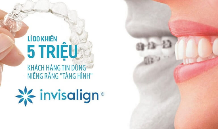 Một quy trình niềng răng Invisalign sẽ bao gồm nhiều bước khác nhau