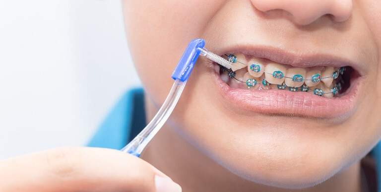 Thói quen chăm sóc răng miệng của bạn không đúng