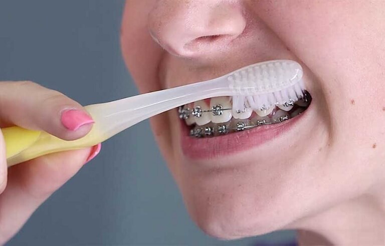 Giữ thói quen chăm sóc răng miệng điều độ để đạt kết quả tốt nhất