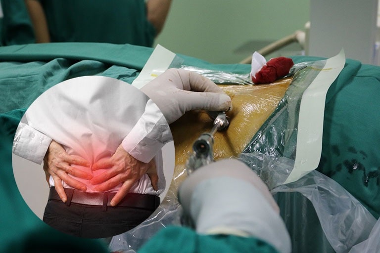 Phẫu thuật được áp dụng khi các biện pháp điều trị thoát vị đĩa đệm thông thường không mang lại hiệu quả