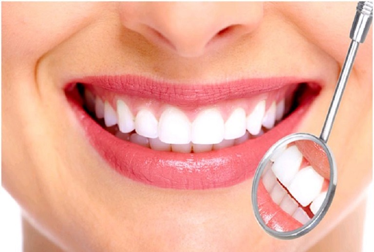 Chi phí bọc răng sứ cho răng lệch lạc là bao nhiêu, đắt hay không?