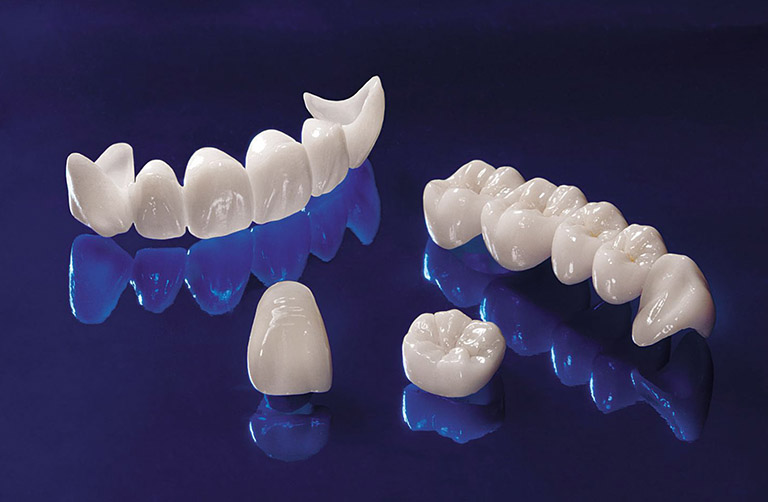 Các loại răng sứ toàn sứ đảm bảo độ bền và tính thẩm mỹ cao