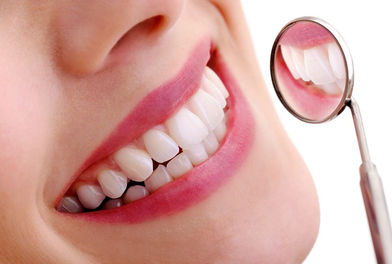 Bọc răng sứ là phương pháp phục hình thẩm mỹ cho răng
