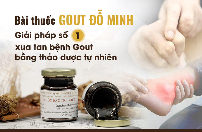 Bài thuốc Gout Đỗ Minh của nhà thuốc Đỗ Minh Đường chữa gout có hiệu quả không? [Review chi tiết]