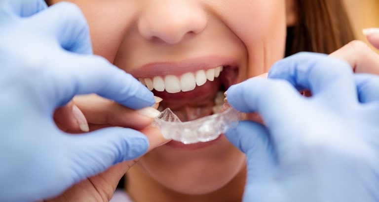 Người bệnh nên lựa chọn địa chỉ niềng răng uy tín để tránh những rủi ro