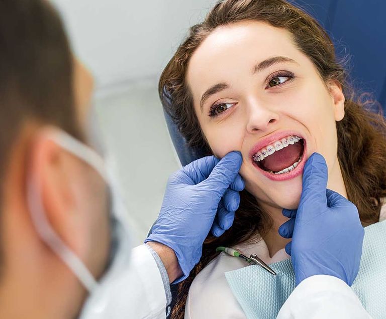 Niềng răng mắc cài sứ dây trong có quy trình tương tự như niềng răng thông thường