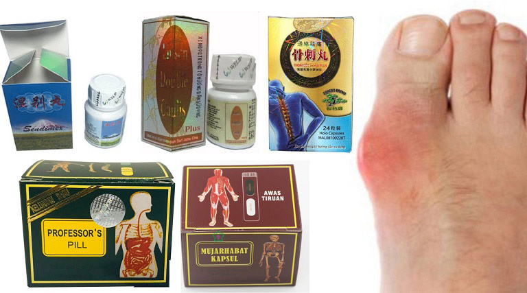 Bật Mí 5 Loại Viên Uống, Thuốc Gout Malaysia Tốt Nhất