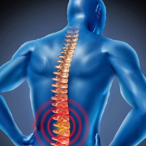 Thoái hóa cột sống lưng là bệnh liên quan đến khớp và cột sống