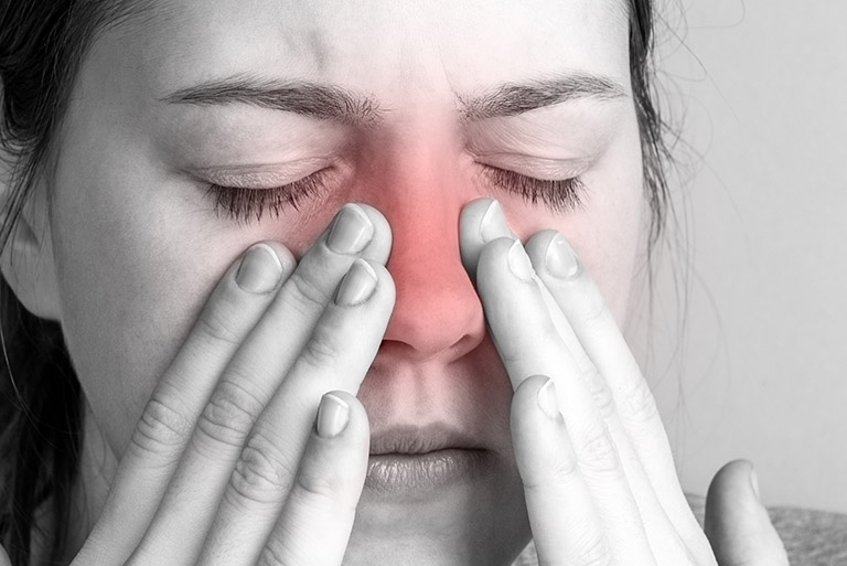 Trì hoãn nâng mũi ở người bị viêm xoang cấp, có bất thường trong mũi hoặc nhiễm trùng đang tiến triển