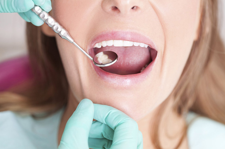 Điều trị kịp thời và dứt điểm bệnh lý răng miệng