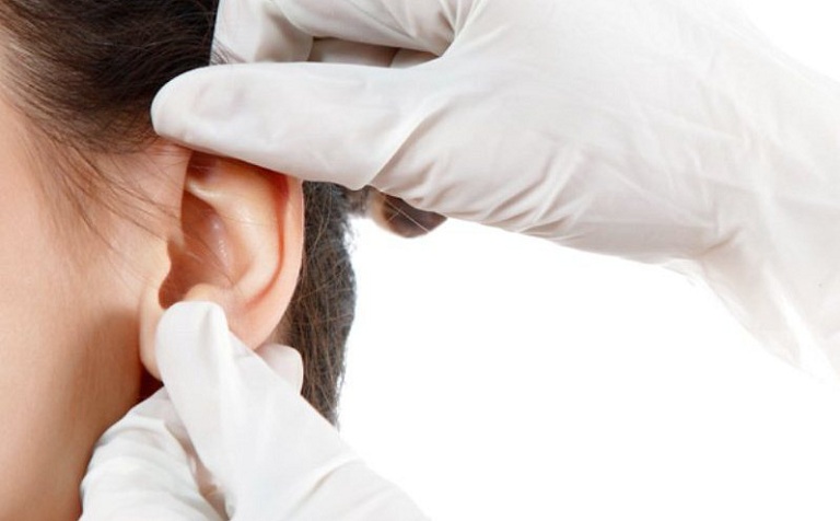 phẫu thuật viêm tai giữa