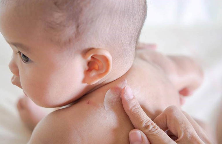 Mẹ cần chú ý việc dưỡng ẩm cho trẻ để cải thiện triệu chứng ngứa ngáy và bong tróc