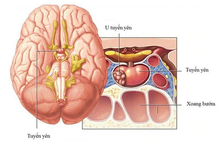 u tuyen yen co nguy hiem khong