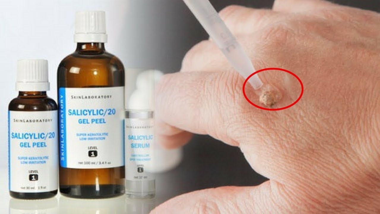thuoc-axit-salicylic-1